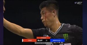 扇耳光大赛选手赵鸿刚：没有想到打成这样，不会为网上言论生气